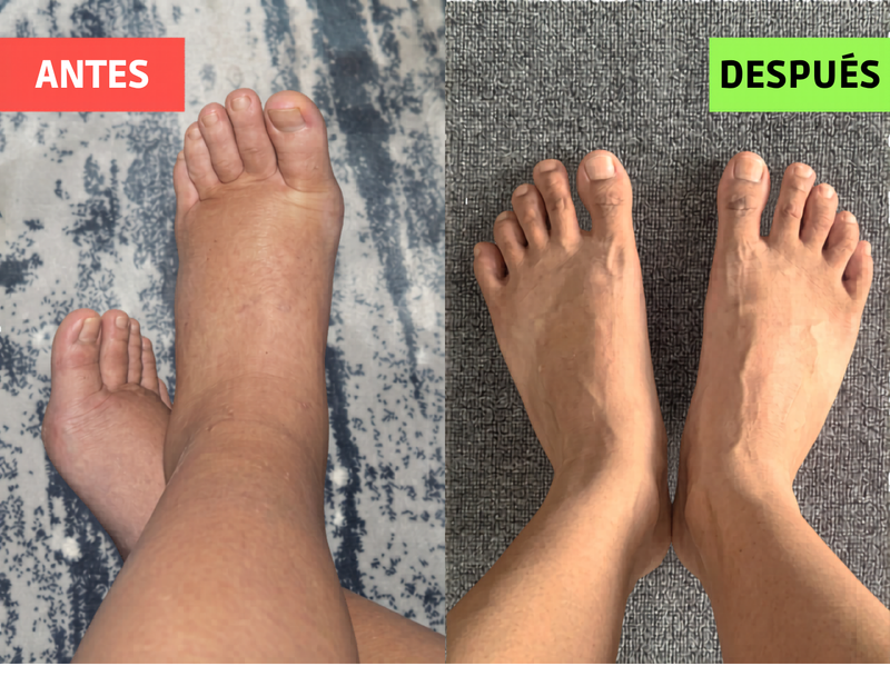 #4 Reduce la sensación de <em>pies hinchados y piernas pesadas</em>