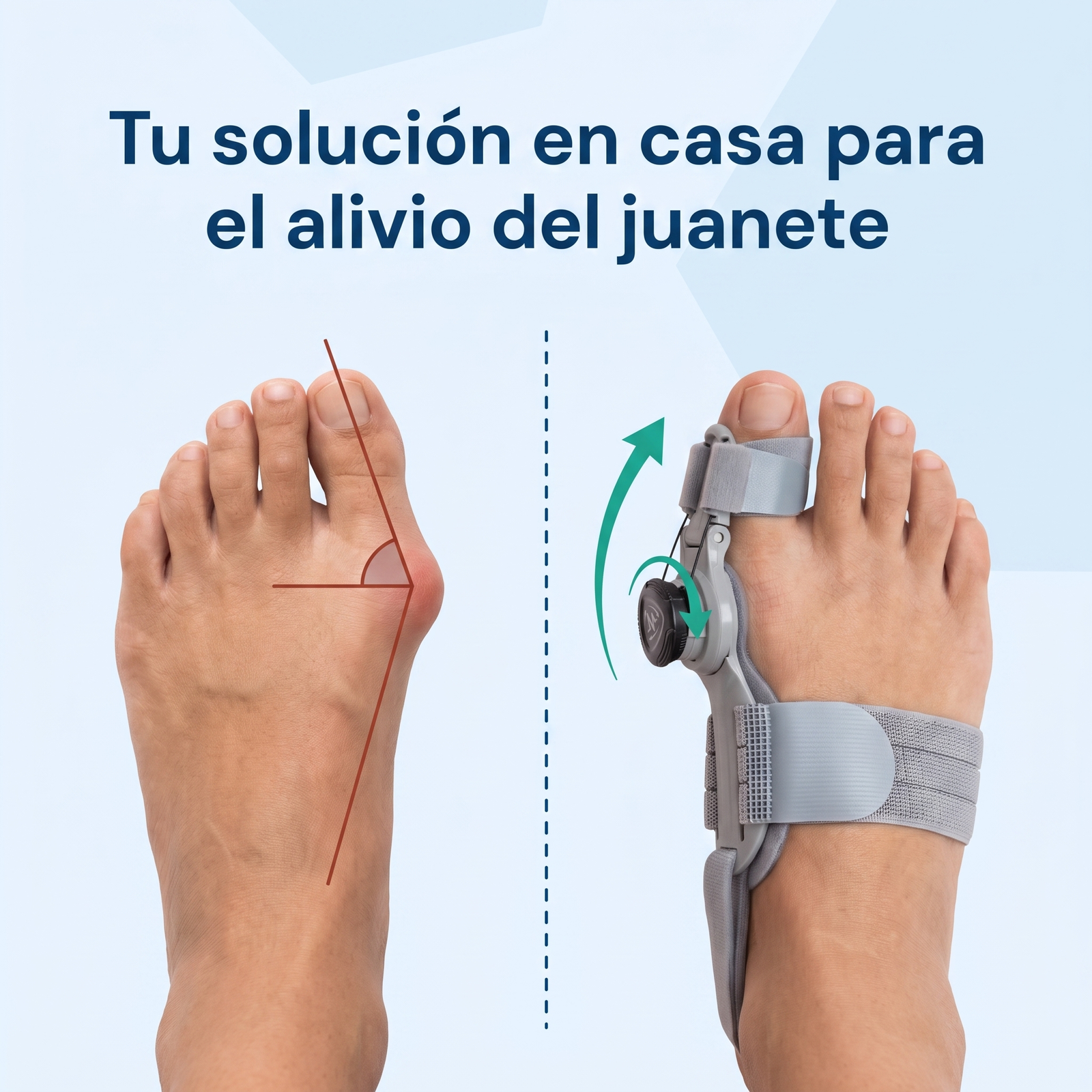 Vivelia AlineaPro™
