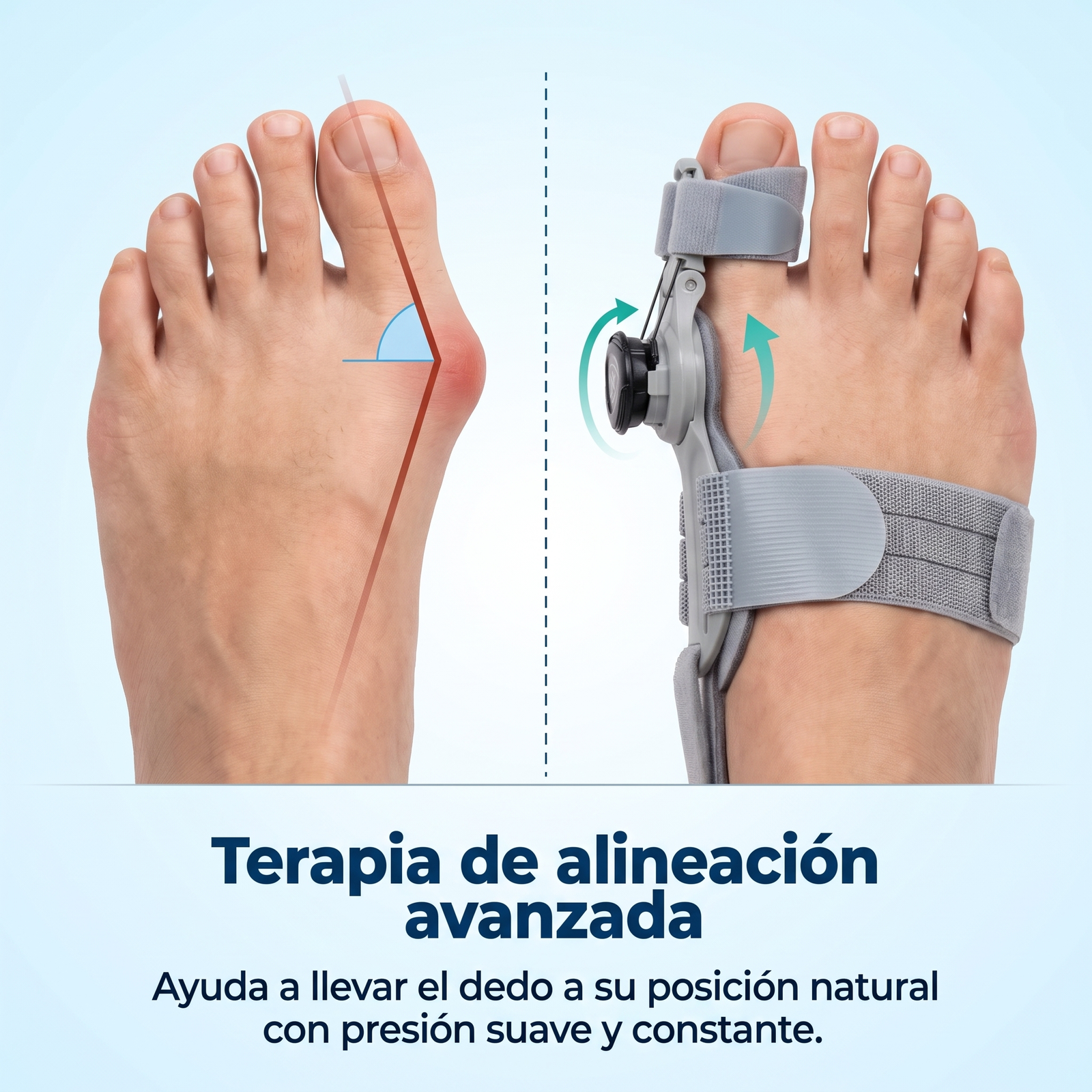 Vivelia AlineaPro™
